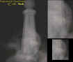 0ballstoneectoplasm.jpg (25233 bytes)